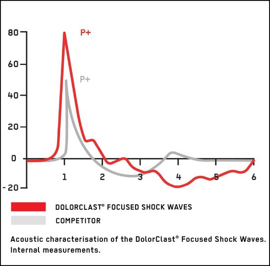 competicion dolorclast focused shock waves