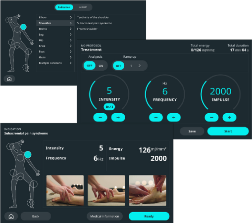 focused shock waves interface