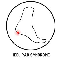heel pad syndrome